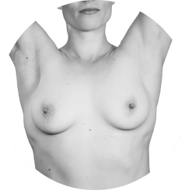 et svart-hvitt bilde av en kvinnes bryst.