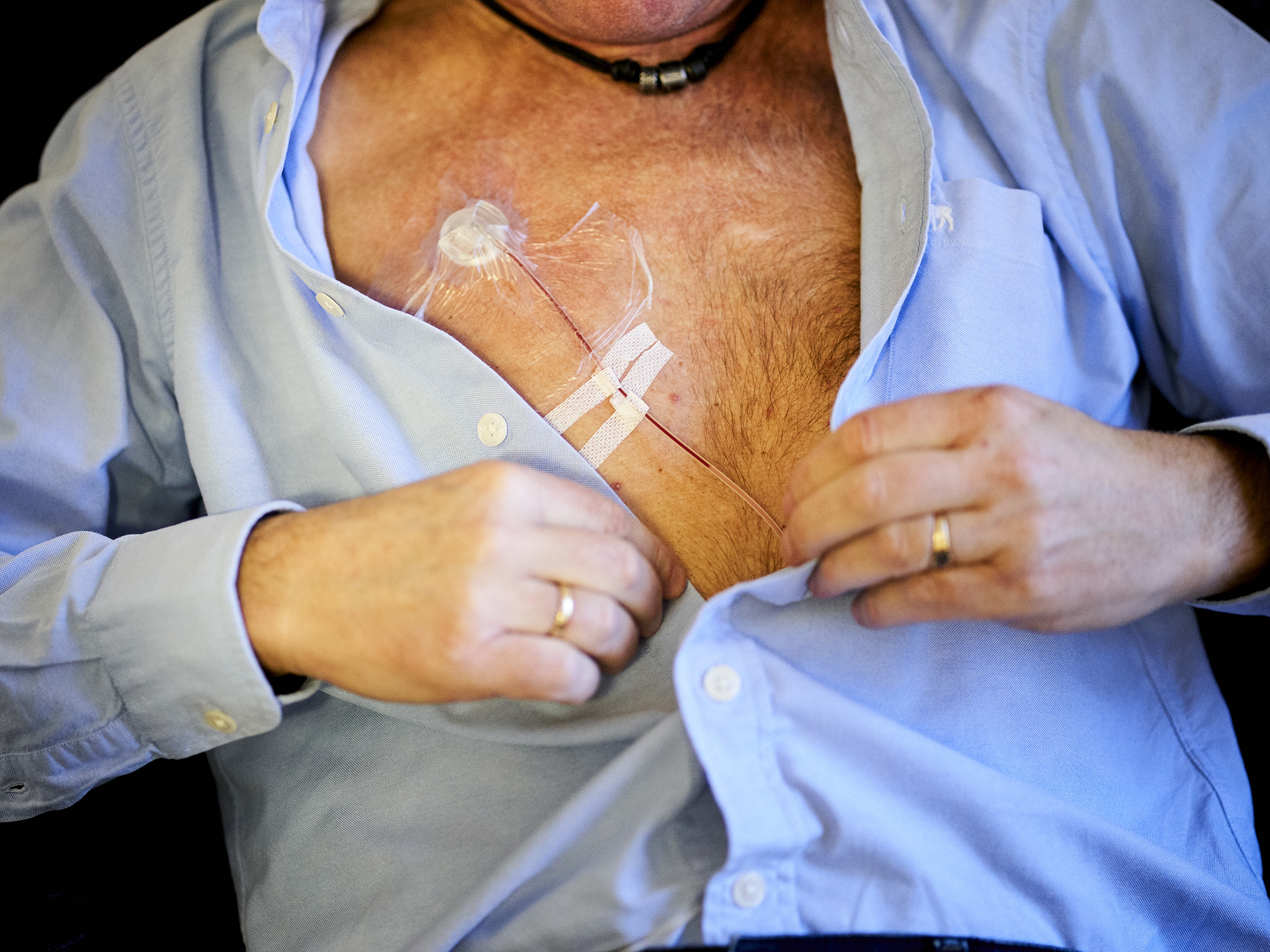 en mann iført en blå skjorte som er kneppet opp og medisinsk utstyr på brystet.