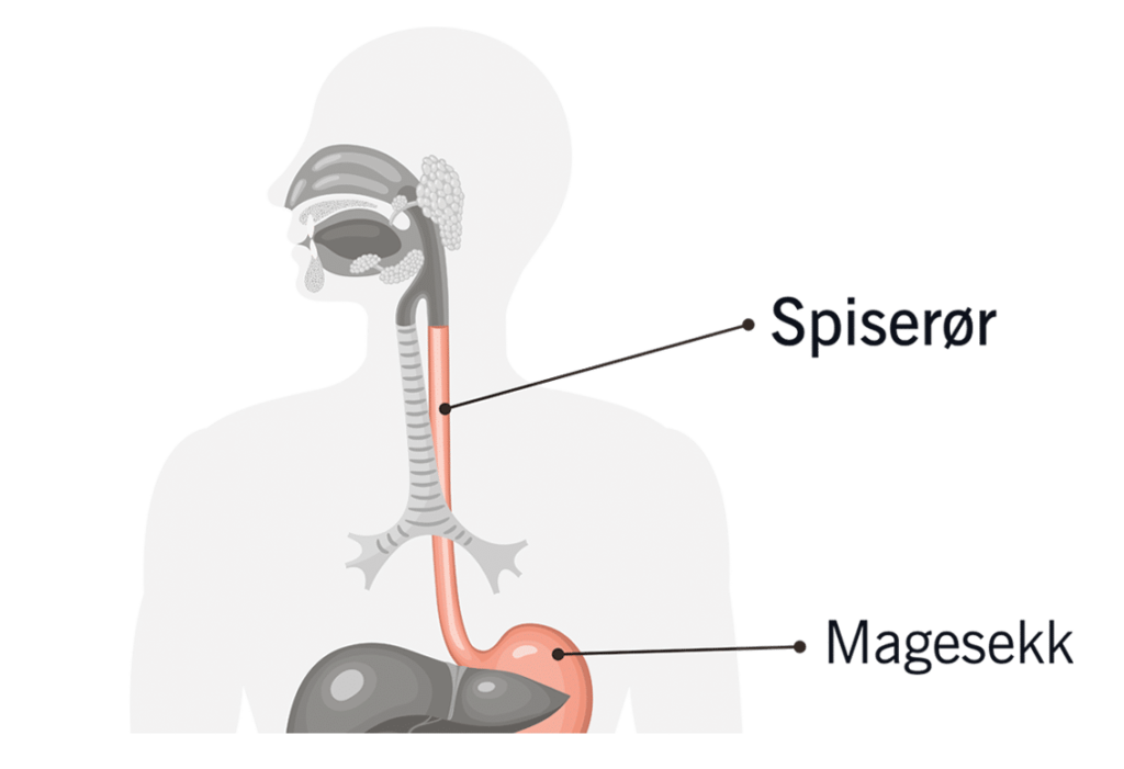 et diagram av en persons nese med et termometer festet til den.