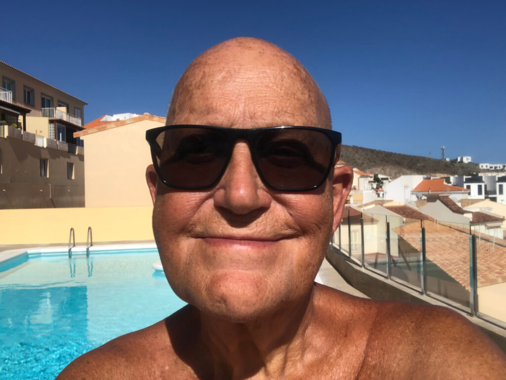 En skallet person med solbriller smiler foran et svømmebasseng, med bygninger og en klar blå himmel i bakgrunnen.