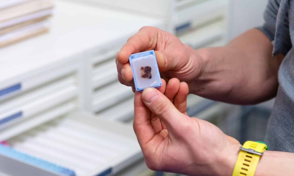 En person holder et objektglass med en vevsprøve i en plastholder, stående foran skuffer.