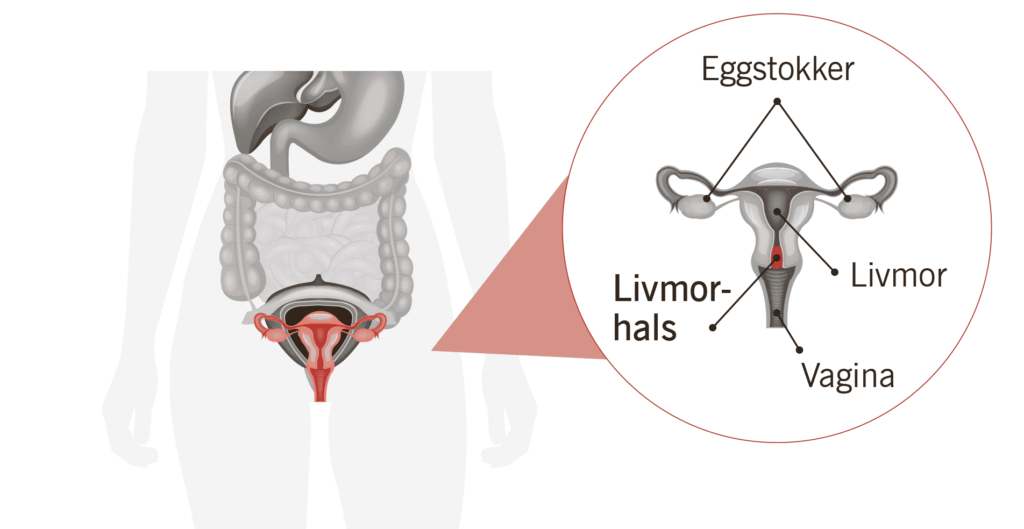 Diagram som viser det kvinnelige reproduksjonssystemet med merkelapper på norsk: eggstokker, livmorhals, livmor og skjede.