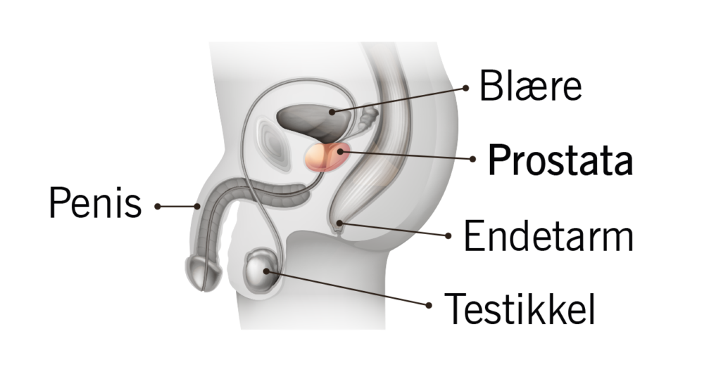 Medisinsk illustrasjon av det mannlige bekkenområdet som viser blære, prostata, penis, endetarm og testikkel med norske etiketter.